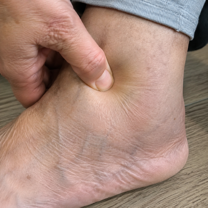 Look at your ankles at 6pm